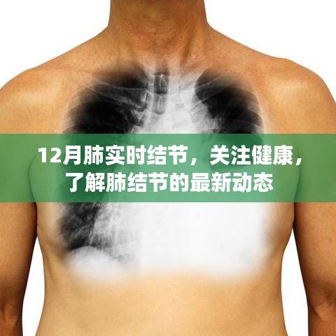 關注健康，12月肺實時結節(jié)最新動態(tài)解讀