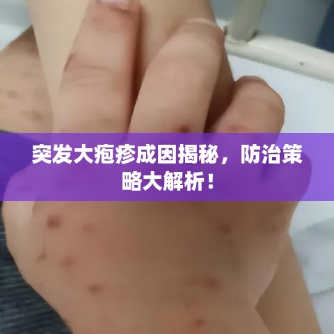 突發(fā)大皰疹成因揭秘，防治策略大解析！