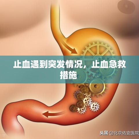 止血遇到突發(fā)情況，止血急救措施 
