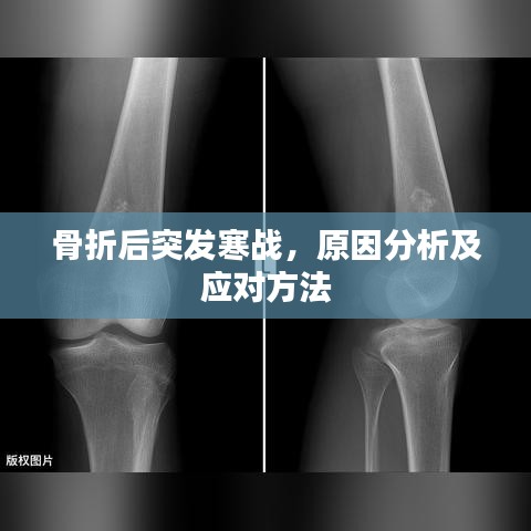 骨折后突發(fā)寒戰(zhàn)，原因分析及應對方法