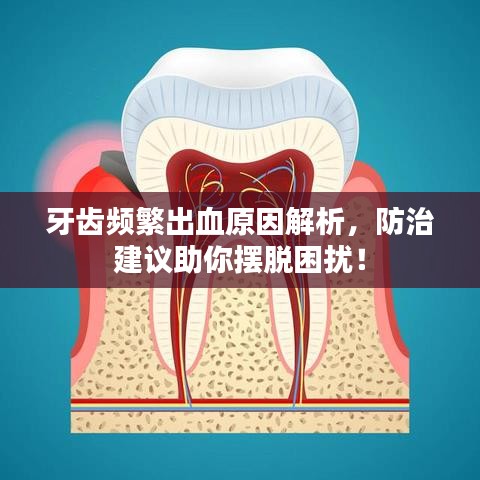 牙齒頻繁出血原因解析，防治建議助你擺脫困擾！