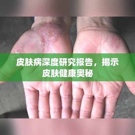 皮膚病深度研究報(bào)告，揭示皮膚健康奧秘