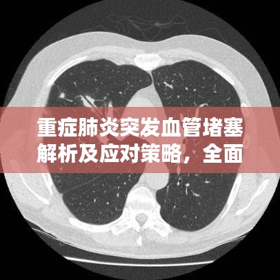 重癥肺炎突發(fā)血管堵塞解析及應對策略，全面探討與應對建議